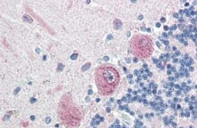 Immunohistochemistry-Paraffin: MLEC Antibody [NBP3-14404]